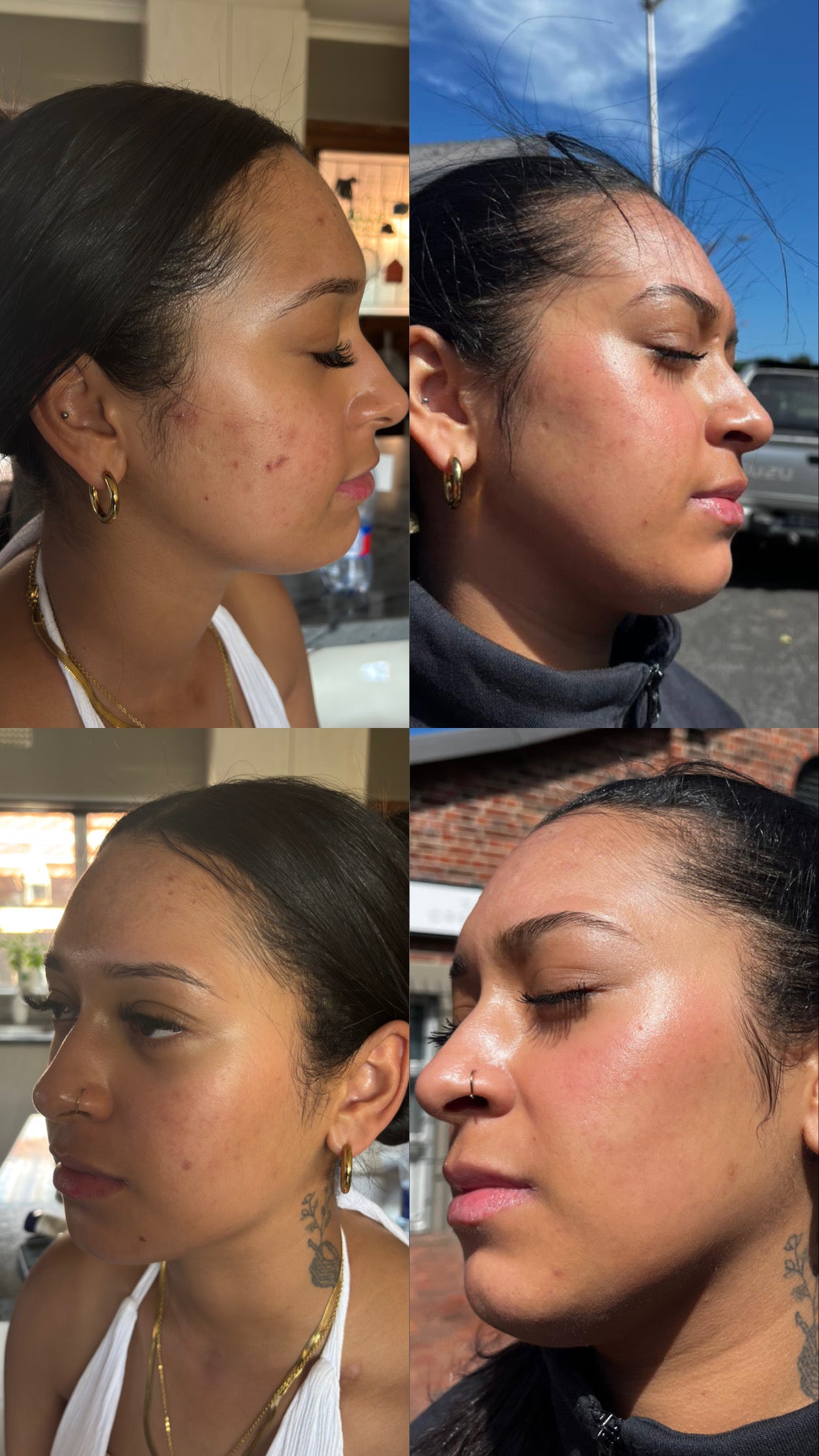 Dry Skin Set